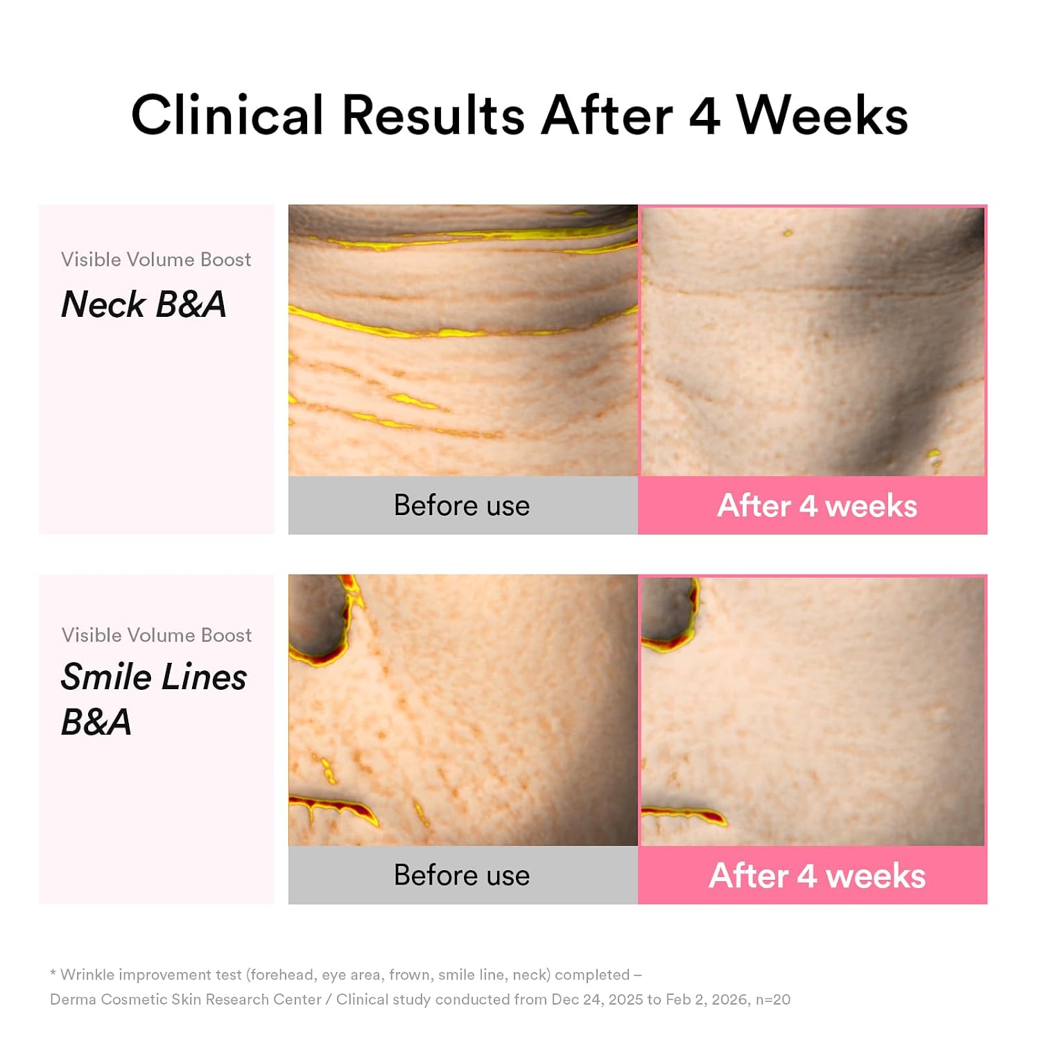 Abib PDRN Volume Fill-it Booster Cream 2.5 Tube [30ml] 